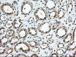 KHK / Ketohexokinase Antibody (clone OTI4E9)