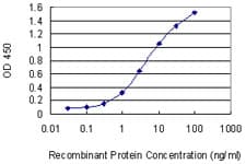 Monoclonal Mouse anti-Human UBE2K / LIG Antibody (clone 1D10, WB)