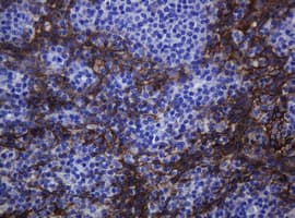 Monoclonal Mouse anti-Human CDH1 / E Cadherin Antibody (clone OTI2F9, IHC, WB)