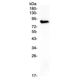 COMP / THBS5 Antibody