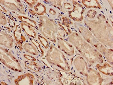 Polyclonal Rabbit anti-Human TWIK1 / KCNK1 Antibody (IHC, IF)