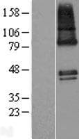 ZDHHC9 Protein (Over-Expression Lysate Myc-DDK (Flag))
