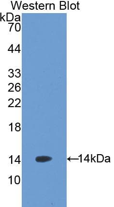 AGRP Antibody (aa21-131, HRP)