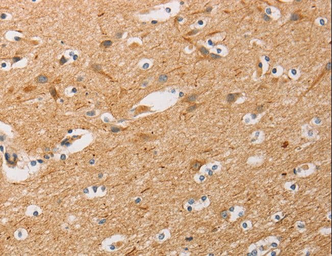 ATG4D Antibody