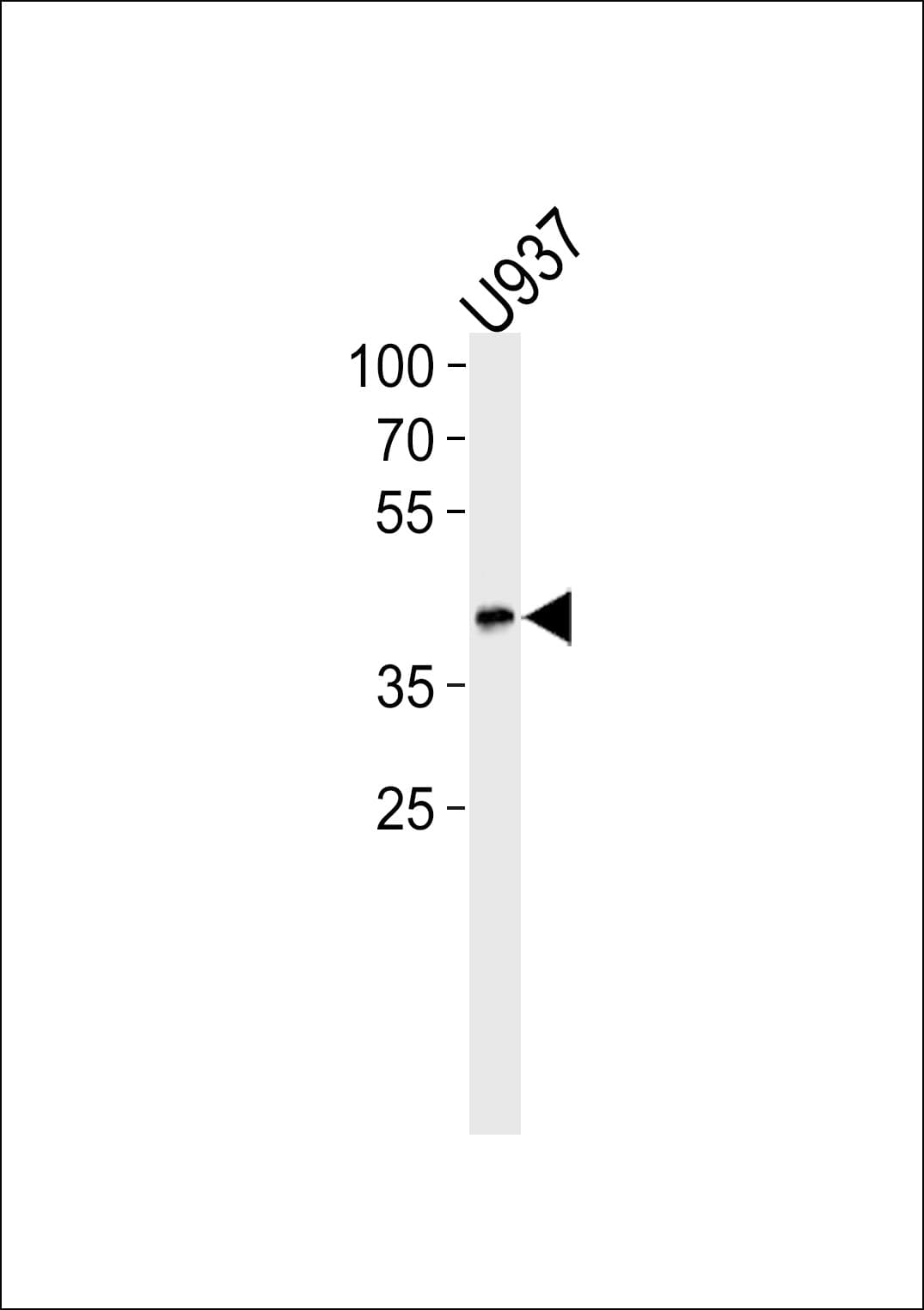 APOL1 / Apolipoprotein L Antibody (aa137-171)