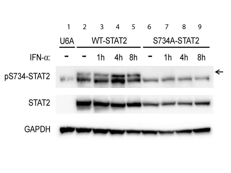 STAT2 Antibody (phospho-Ser734)