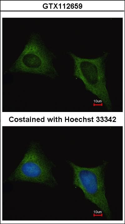 TUBB / Beta Tubulin Antibody