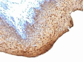 Cytokeratin 10+13 Antibody (clone DE-K13)