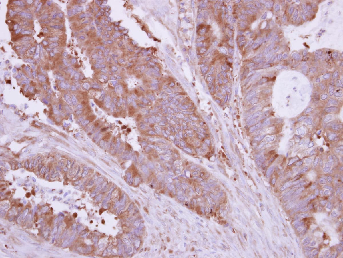 HIP1R Antibody (N-Terminus)