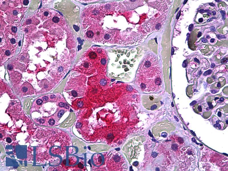 IHC-plus™ Monoclonal Mouse anti-Human GALT Antibody (clone 4C11, IHC, WB)