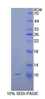Mouse COL2A1 / Collagen II Alpha 1 Protein (Recombinant His)