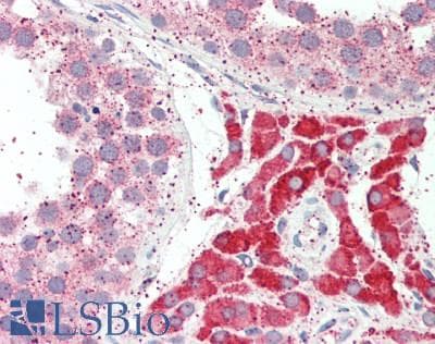IHC-plus™ FDFT1 / Squalene Synthase Antibody