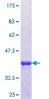 Human KRT36 / Keratin 36 / KRTHA6 Protein (Recombinant GST, N-terminus)