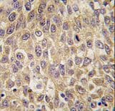 Alpha-Fetoprotein Antibody (aa56-85)