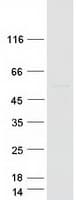 Human AK9 / AKD1 / AKD2 Protein (Recombinant Myc-DDK (Flag))