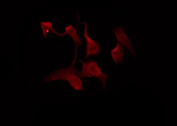 OR10AD1 Antibody