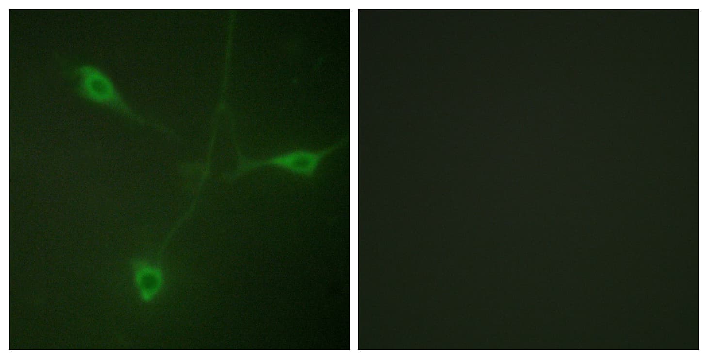 HSP90 Beta Antibody (phospho-Ser226)