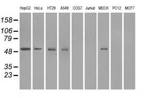Monoclonal Mouse anti-Human FH / Fumarase / MCL Antibody (clone OTI2A2, IF, WB)