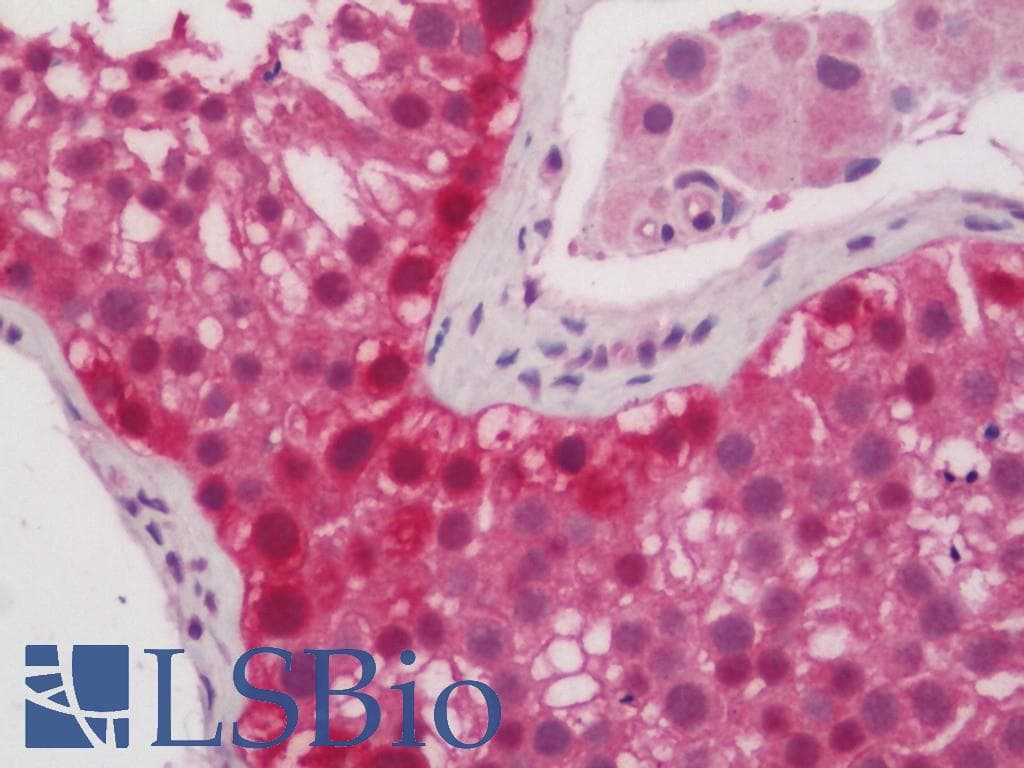 IHC-plus™ Cullin 4A / CUL4A Antibody (aa102-131)