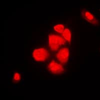 CSE1L Antibody (N-Terminus)