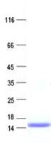 Human SPINK8 Protein (Recombinant His, N-Terminal)