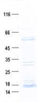 Human DMTN / Dematin Protein (Recombinant DDK,C-terminus)