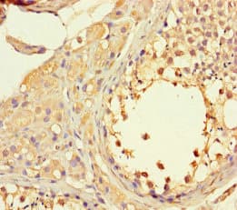 Polyclonal Rabbit anti-Human LTV1 Antibody