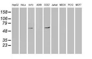 TP53 / p53 Antibody (clone OTI2E4, Carrier-free)