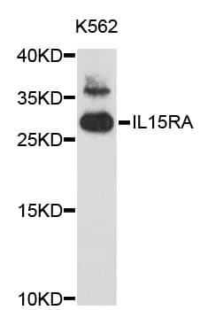 Polyclonal Rabbit anti-Human IL15RA Antibody (WB)