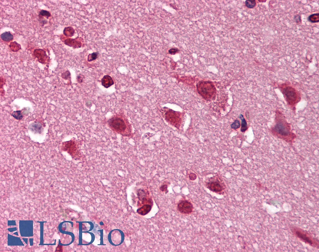 IHC-plus™ DNM1 / Dynamin Antibody (C-Terminus)