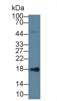 LCN1 / Lipocalin-1 Antibody (aa24-172)