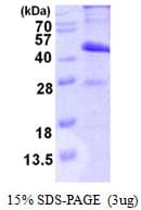 Human CMT2 / MAD2L1BP Protein (Recombinant His)