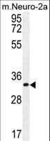 Polyclonal Rabbit anti-Human ZC3H8 Antibody (aa52-81, WB)