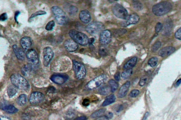 Polyclonal Rabbit anti-Human MAP3K5 / ASK1 Antibody (Glu960, IHC, WB)