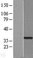 GTF2H3 Protein (Over-Expression Lysate Myc-DDK (Flag))