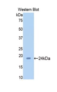 SIRT5 / Sirtuin 5 Antibody (aa48-244)