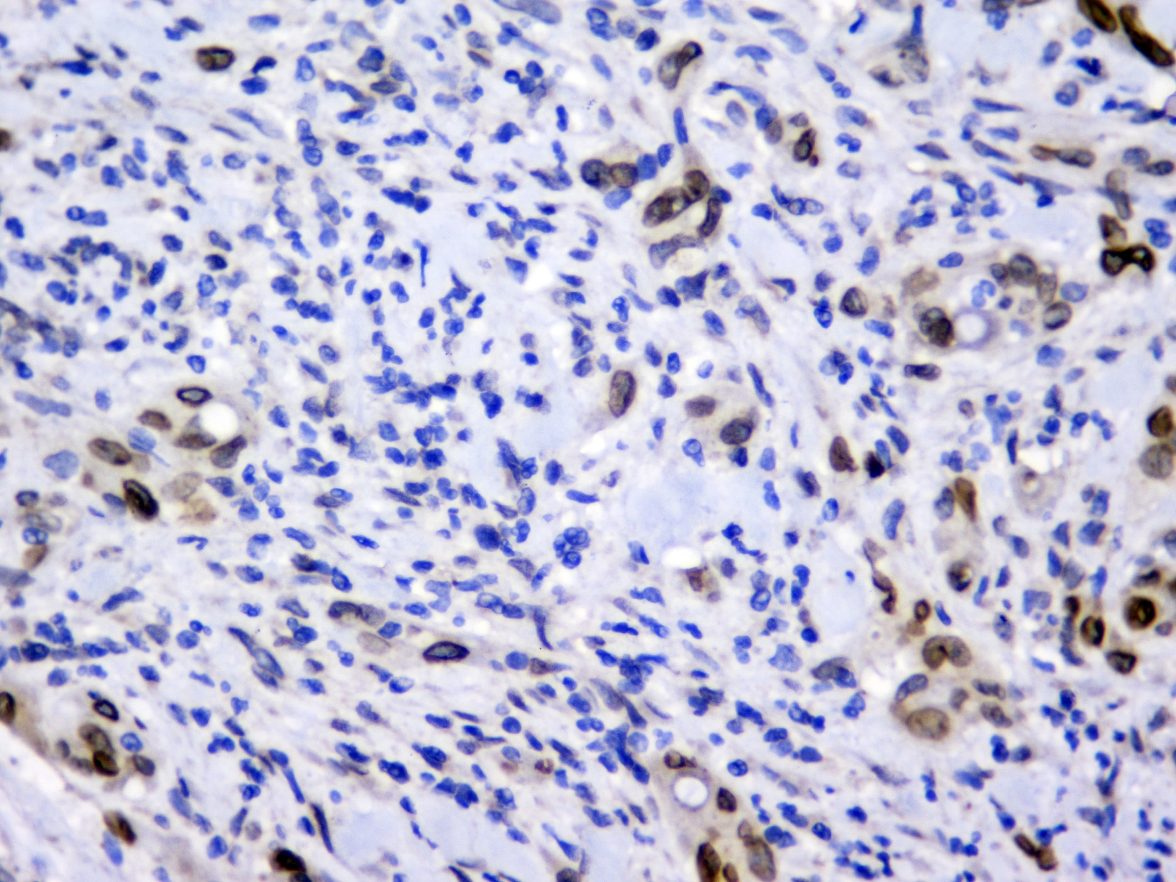 Monoclonal Mouse anti-Human EMD / Emerin Antibody (IHC, WB)