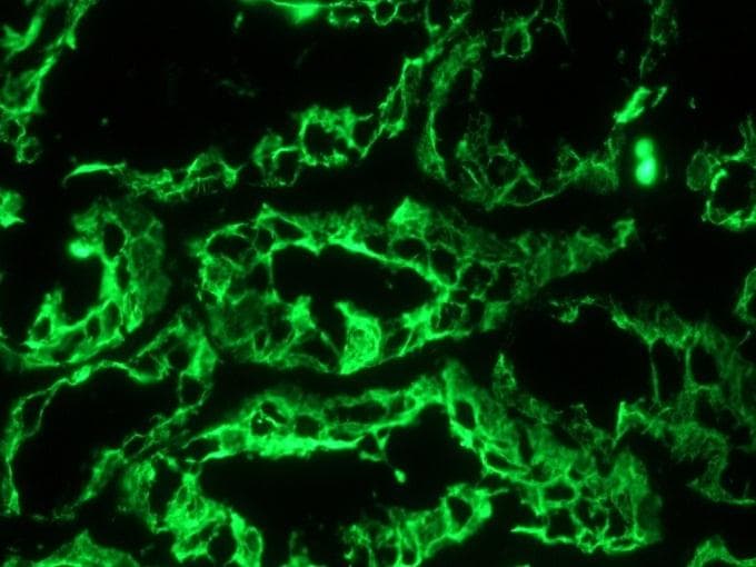 PathPlus™ Monoclonal Mouse anti-Human KRT18 / CK18 / Cytokeratin 18 Antibody (clone RCK106, IHC, WB)