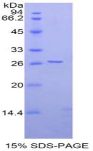 Rat EFNA4 / Ephrin A4 Protein (Recombinant His-T7)