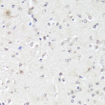 EGFR Antibody