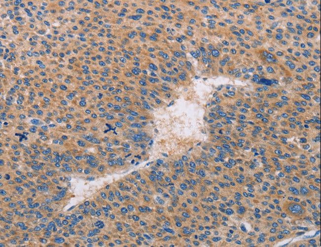 CASP10 / Caspase 10 Antibody