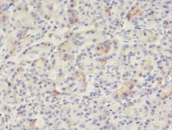 VWA5B2 Antibody