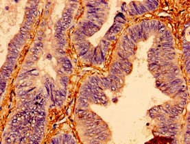 Polyclonal Rabbit anti-Human BTF3 Antibody (WB)