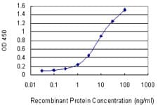 FLI1 Antibody (clone 1G8)