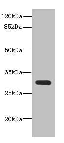 Polyclonal Rabbit anti-Human CD200 Antibody (WB)