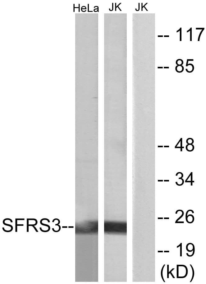 IHC-plus™ SRSF3 / SRP20 Antibody (aa111-160)