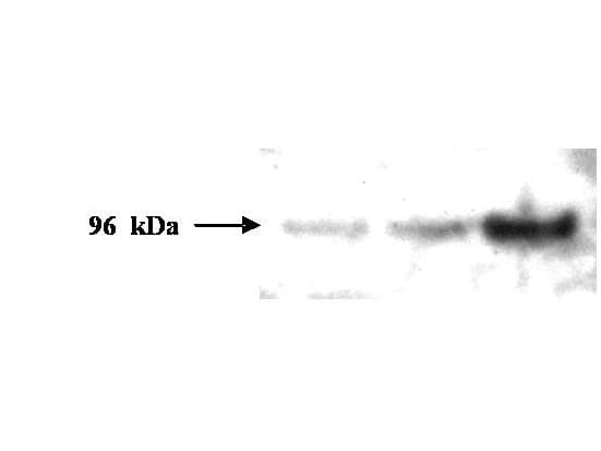 Monoclonal Mouse anti-Human PMS2 Antibody (clone 1204, aa1-133, WB)