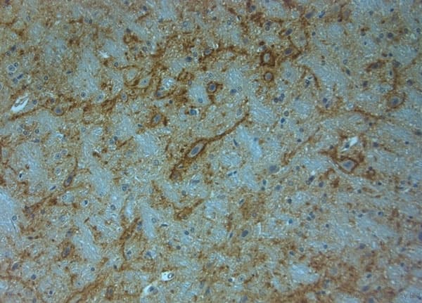 Polyclonal Rabbit anti-Human ACAN / Aggrecan Antibody (aa200-250, IHC)