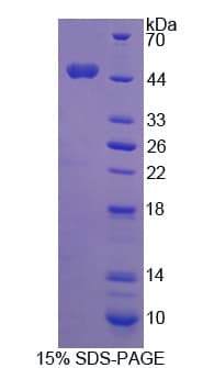 Human CDK8 Protein (Recombinant His)