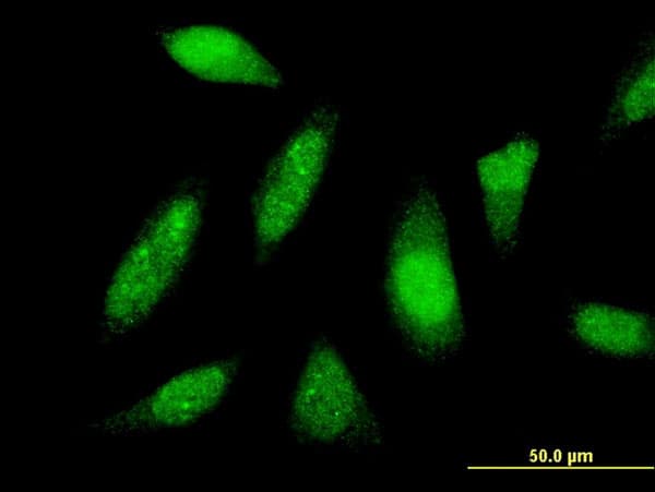Monoclonal Mouse anti-Human PTTG1IP / PBF Antibody (clone 4C11, IF, WB)